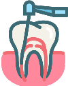 Endodontinis gydymas Šiauliuose
